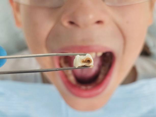 Best Emergency Pediatric Dental Care in Galena, KS